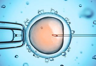体外受精 IVF-ET